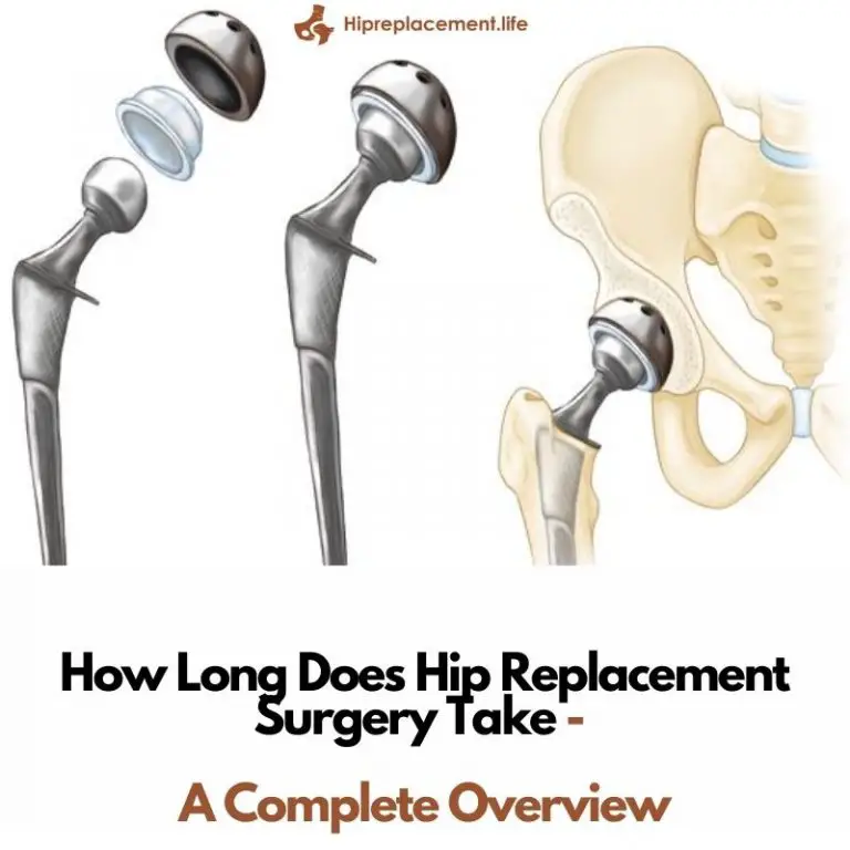 How Long Does A Total Hip Replacement Take