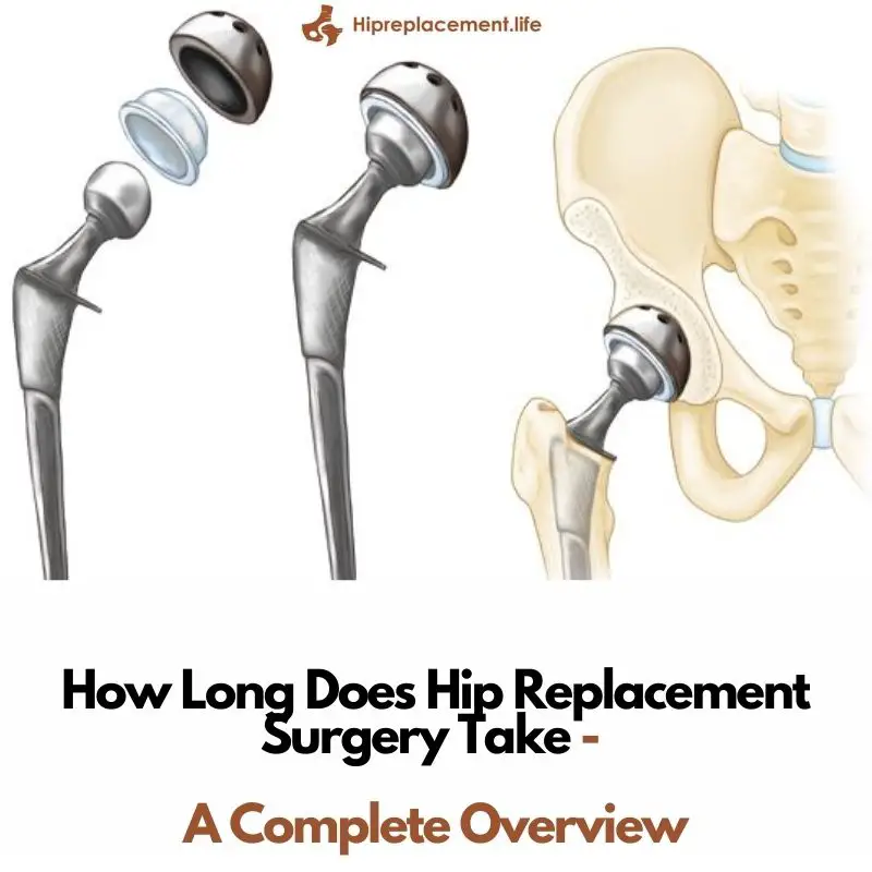 hip-replacement-recovery-tips-from-doctors-and-patients