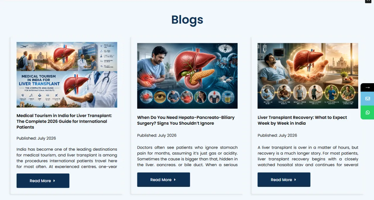 Livertransplantexpert