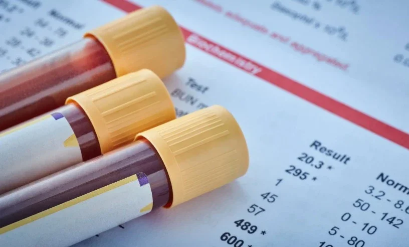 Biyokimya Testi Nedir? Hangi Hastalıkları Gösterir?