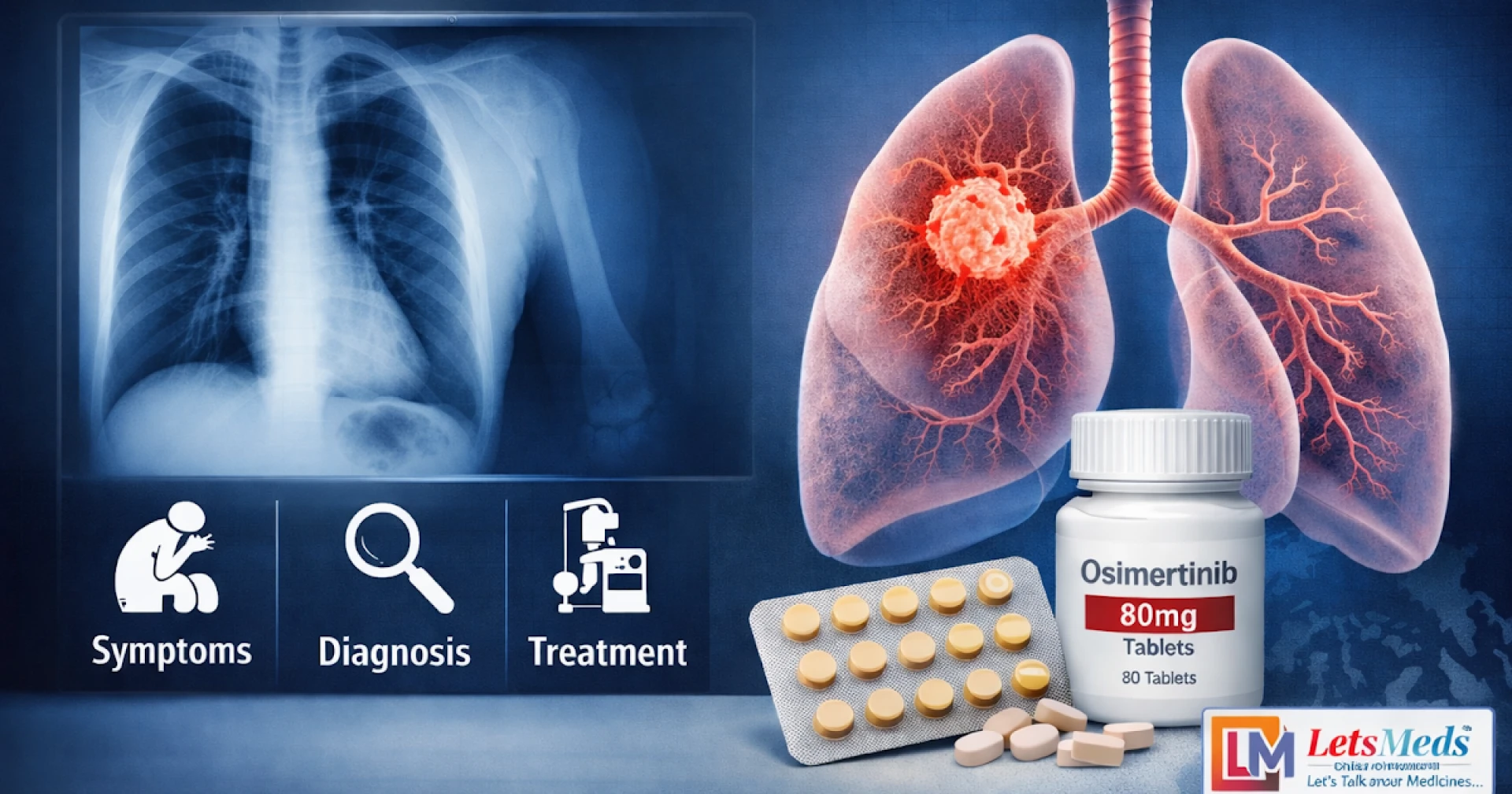 Lung Cancer Awareness in the Philippines: What to Know About NSCLC