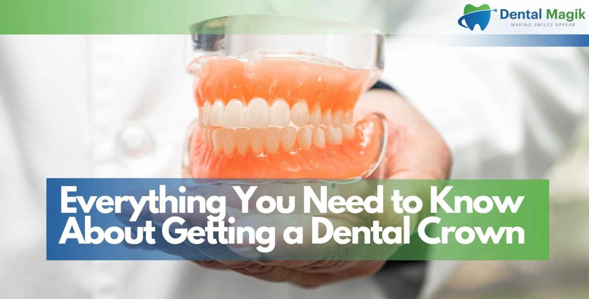 Everything You Need to Know About Getting a Dental Crown