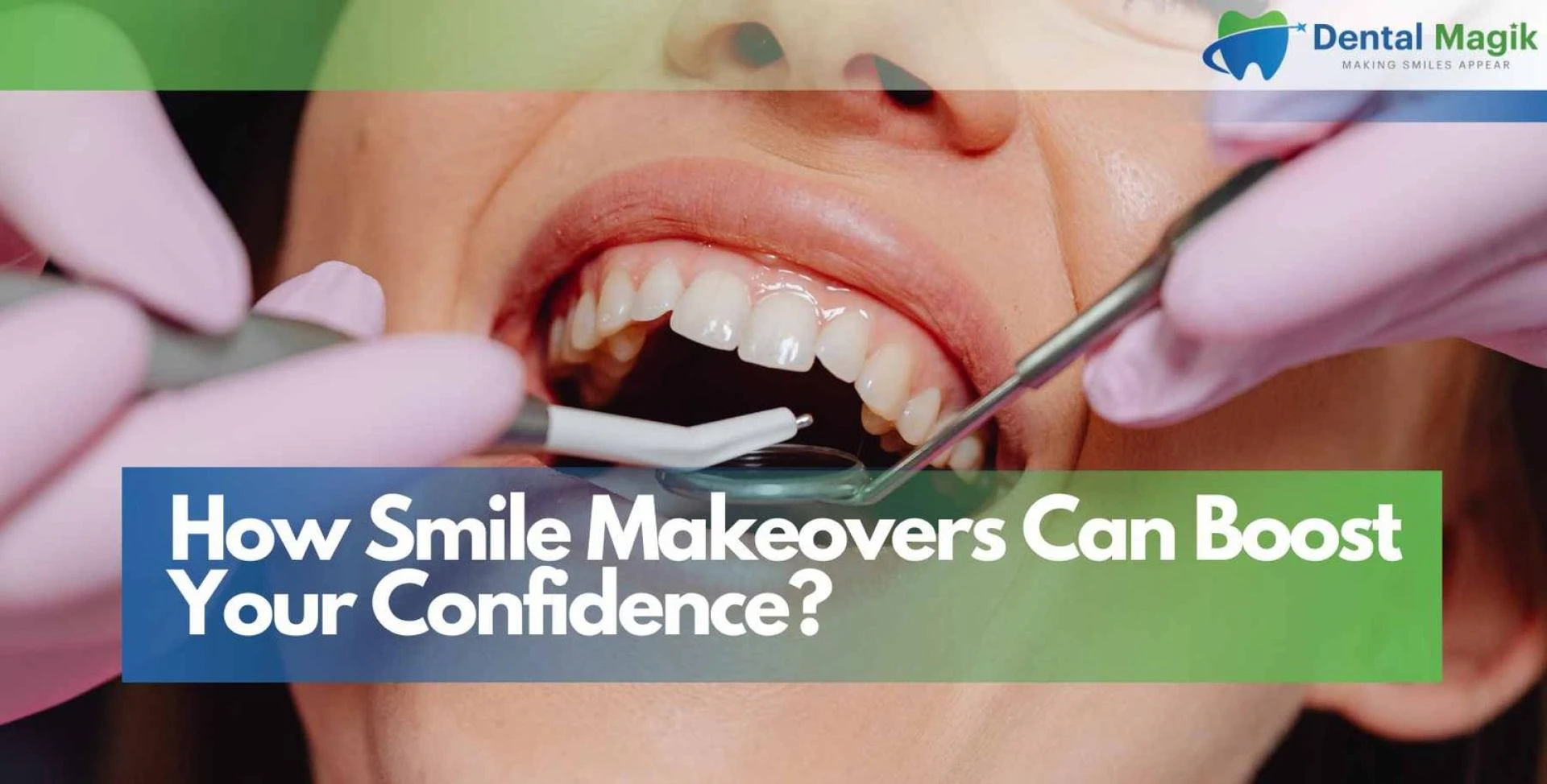 How Smile Makeovers Can Boost Your Confidence?