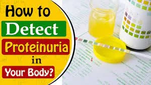 How Long Do Proteinuria Patients Live?
