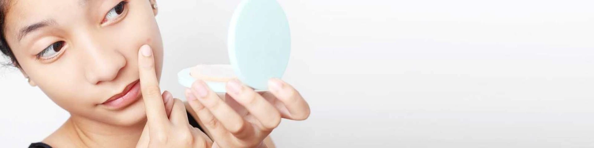 How to Get Rid of Chin Acne, According to Dermatologist