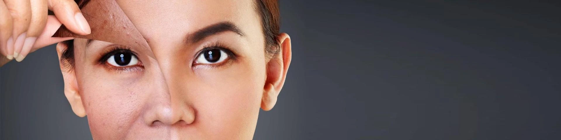 5 Tips To Manage Skin Pigmentation Problems