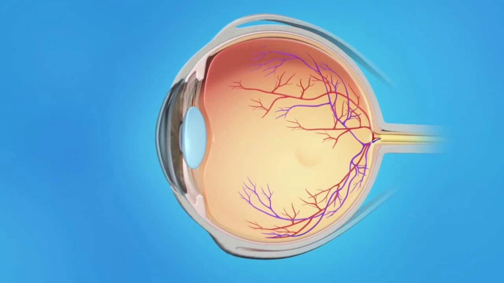 Diabetic Retinopathy Market Size, Share, Growth, Outlook, and Opportunity Analysis, Forecast 2019 - 2027