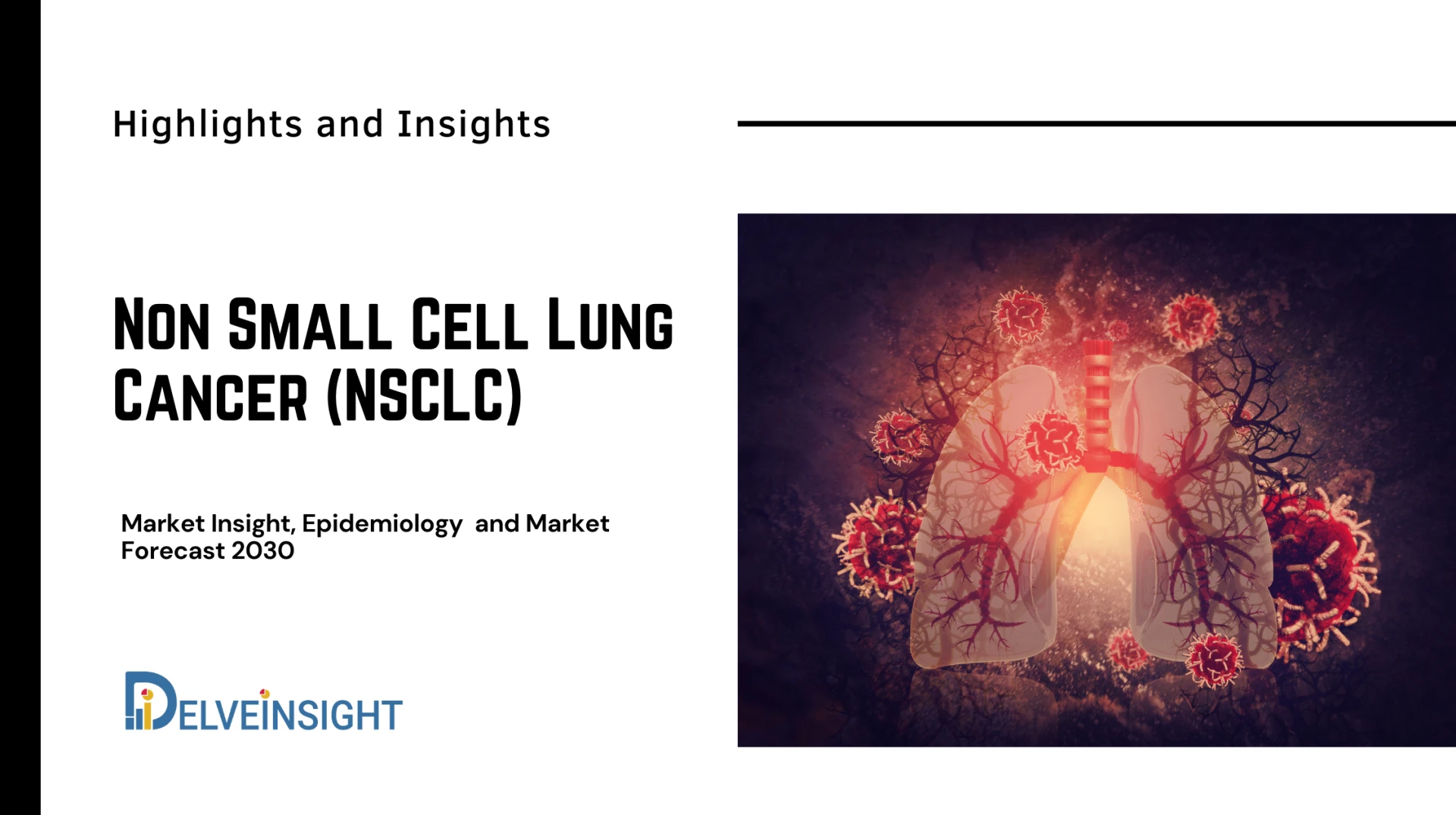 What is Non-Small Cell Lung Cancer (NSCLC)?