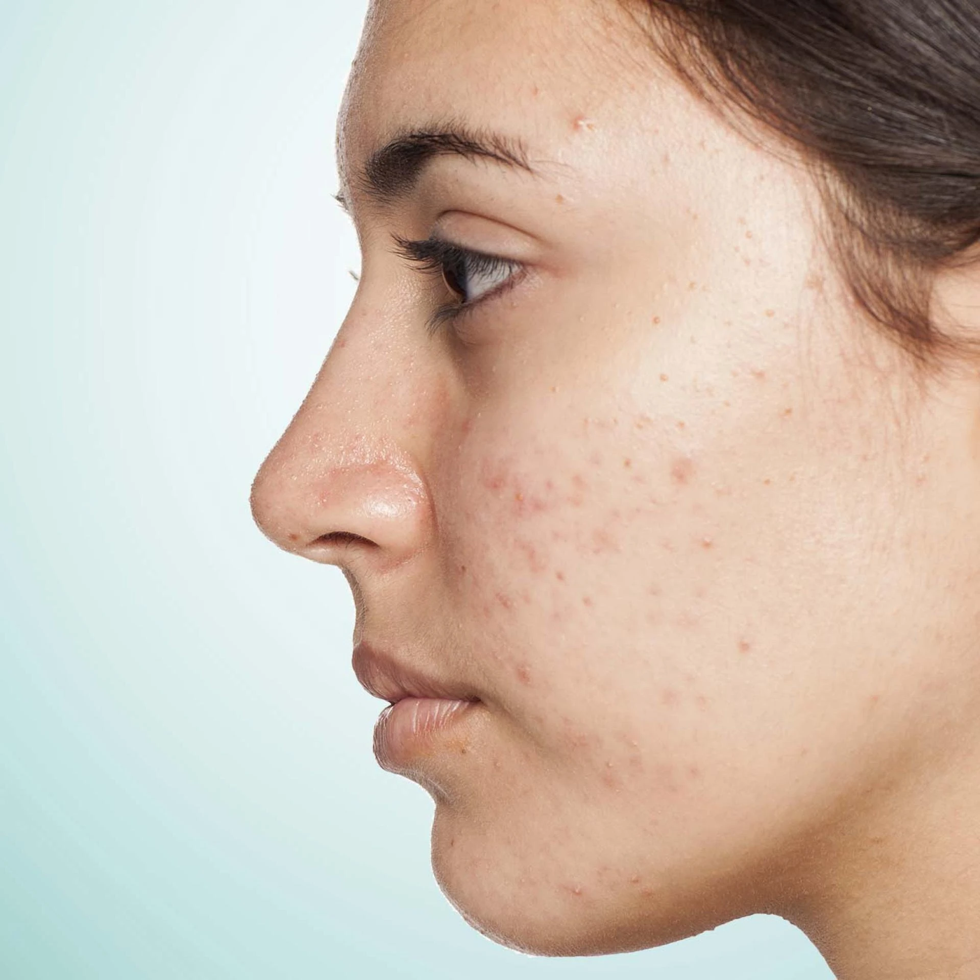 Improve the Appearance of Scars with These 5 Tips