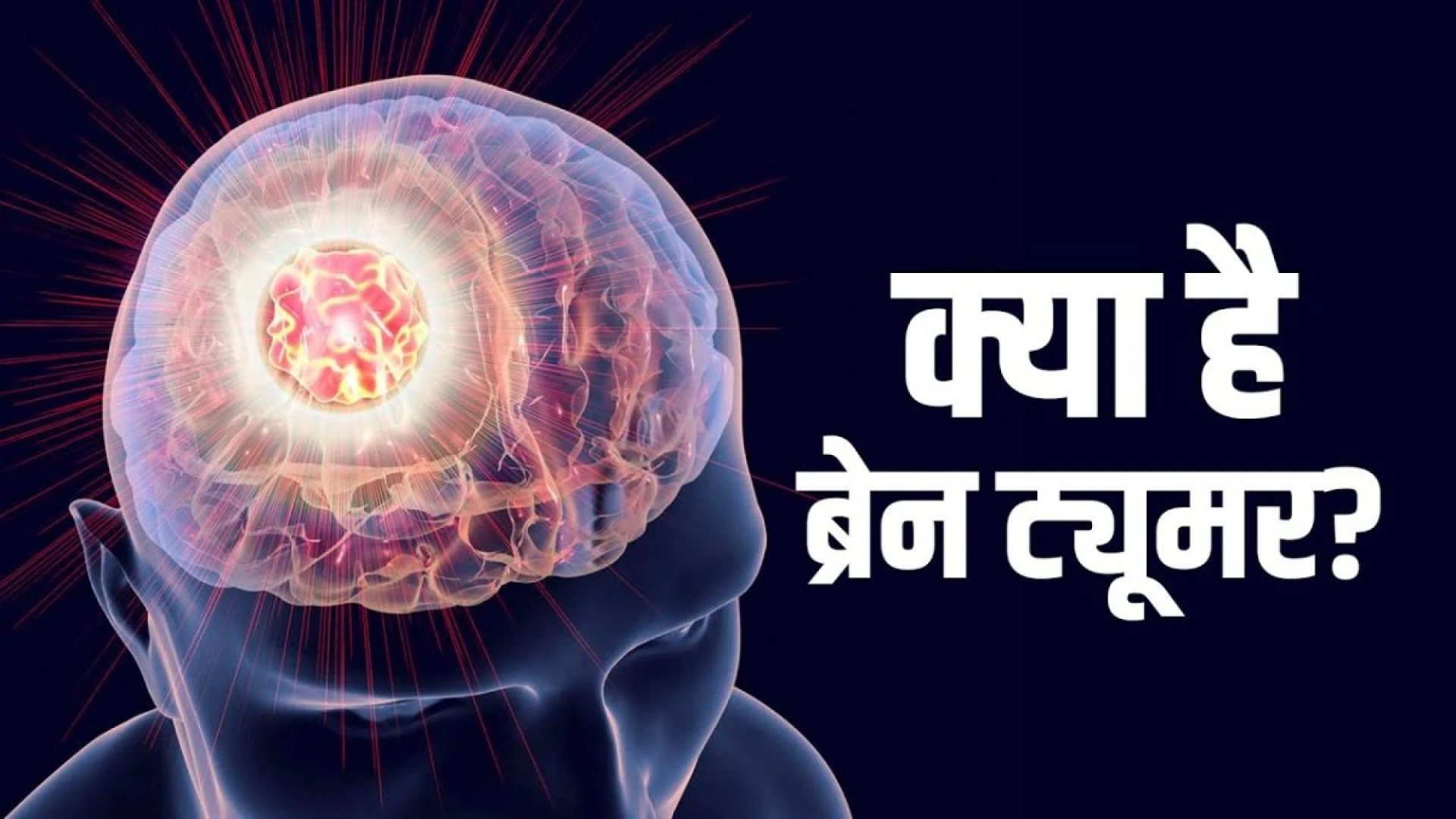 Brain Tumor है खतरनाक, जाने लक्षण और उपायों के बारे में | Brain Tumor Symptoms, Causes &amp; Treatment