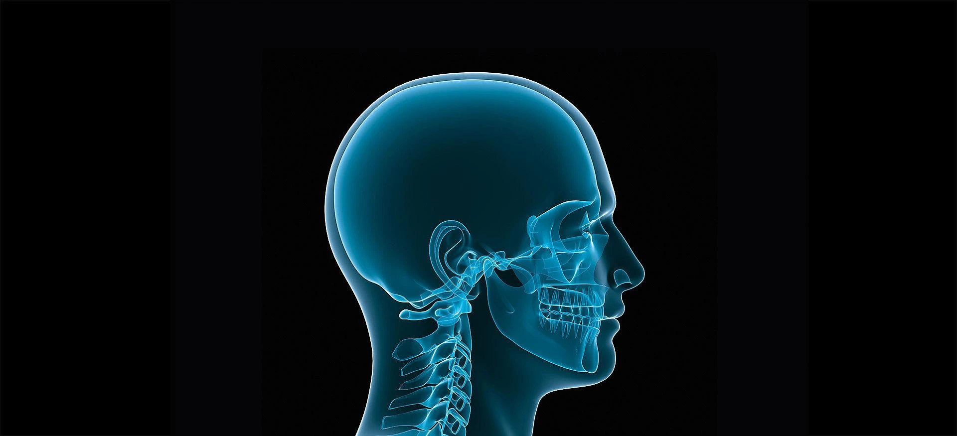 Craniomaxillofacial (CMF) Devices Market 2024: Size, Share, Latest Trends, Analysis and Forecast to 2032
