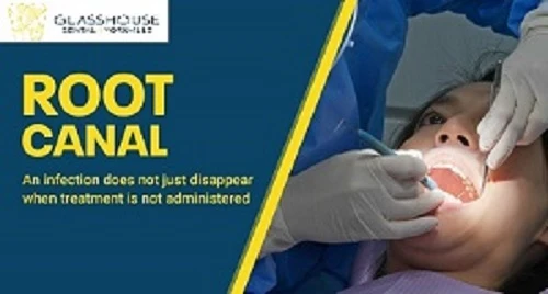 5 Surprising Things You Didn't Know About Cheap Root Canals