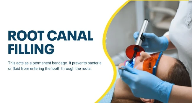 Can a root canal fail after 10 years? What is Root Canal Failure in Reality?