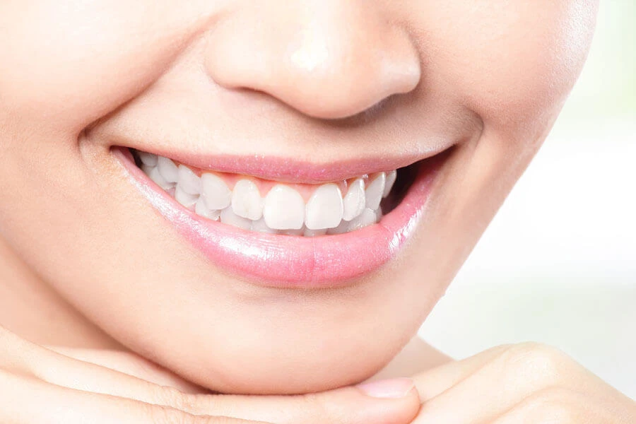 The Secrets to Long-Lasting Teeth Whitening Results: Expert Tips