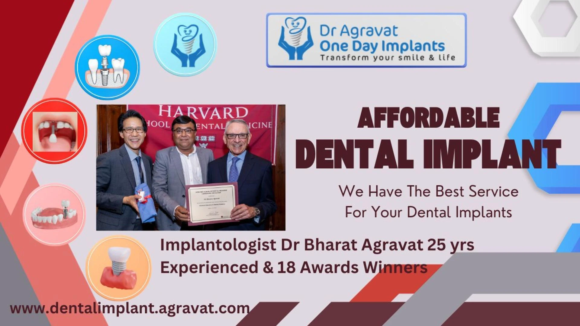 Affordable Dental Implants Cost in Ahmedabad GujaratIndia: Exploring Price Factors for Quality Dental Implants Surgery