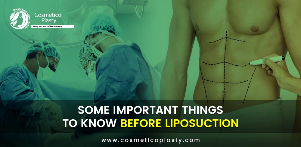 Some important things to know before liposuction