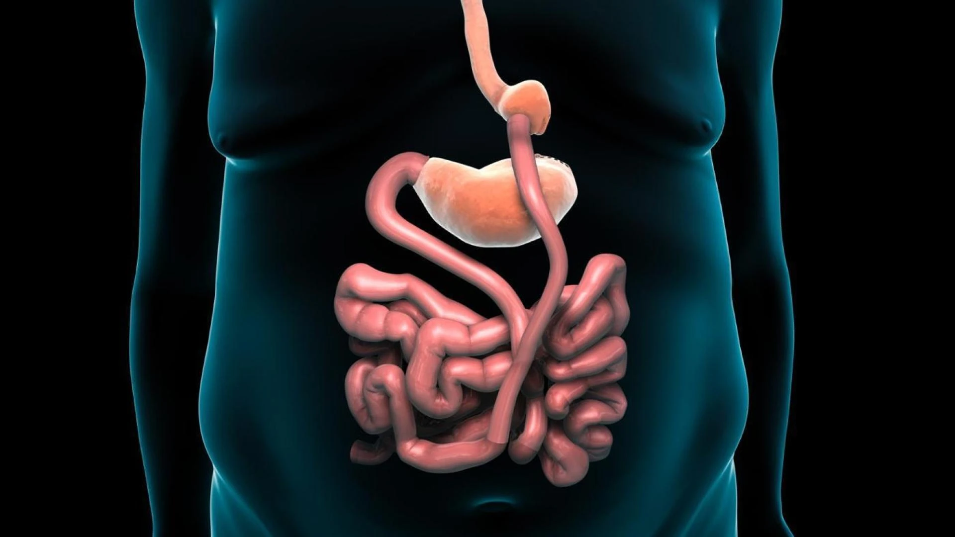 Roux-en-Y Gastric Bypass Surgery for Weight Loss