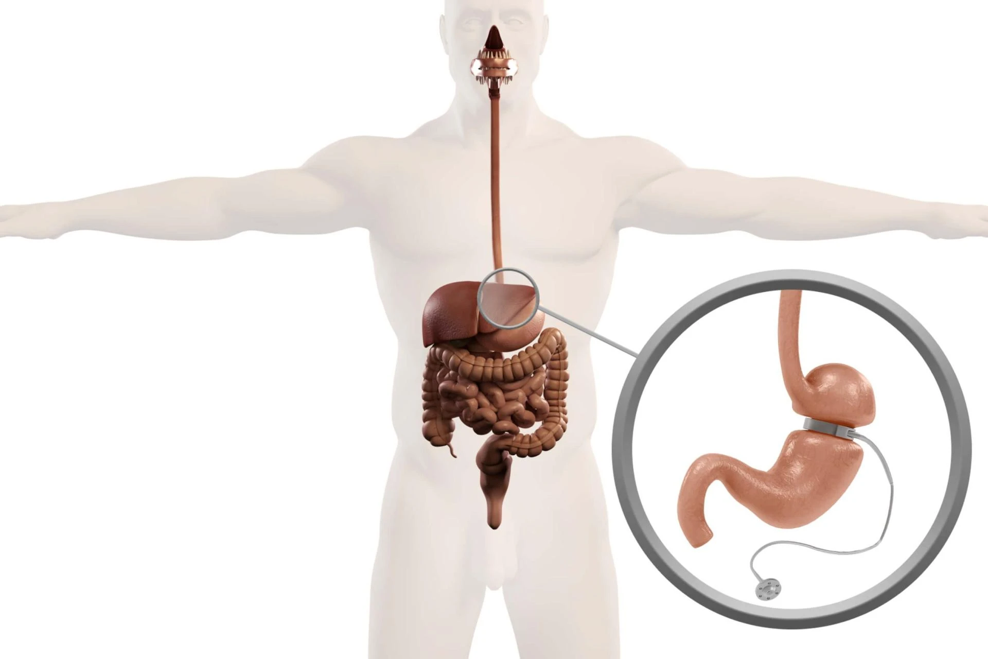 Bariatric Surgery in Mumbai: Your Guide to Transformation and Costs (2023)