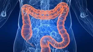 How to have a safer colonoscopy