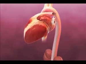 Global Medical Manifolds Market Growth, Trends, and Forecast 2021 to 2027