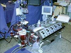 Global Artificial Heart Lung Machines Market Analysis by Product Type, Applications, Company Profile