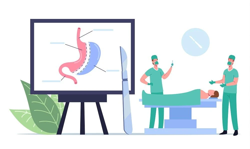 Upper Endoscopy: What Is It, Who Needs It, Risks &amp; Benefits