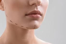 تعزيز ملف الوجه الخاص بك مع تكبير الذقن