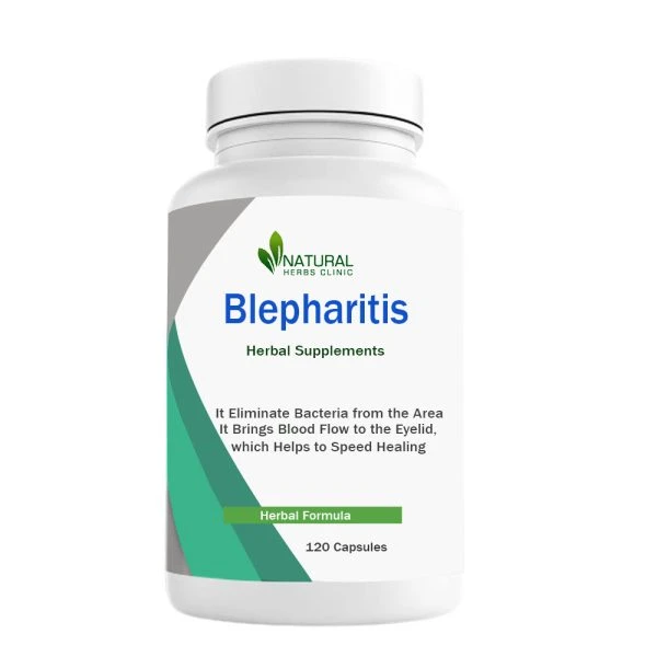 Herbal Treatment for Blepharitis | Natural Remedies | Natural Herbs Clinic