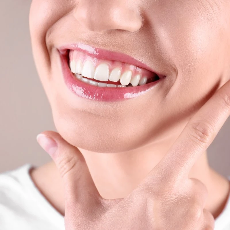 Smile Makeovers in Houston: A Comprehensive Guide