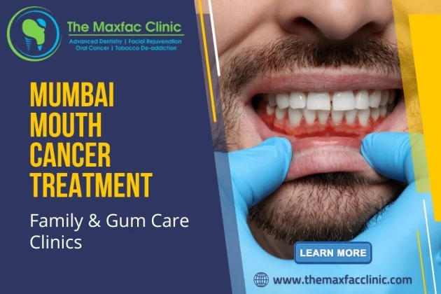 Mumbai Mouth Cancer Treatment | Family &amp; Gum Care Clinics