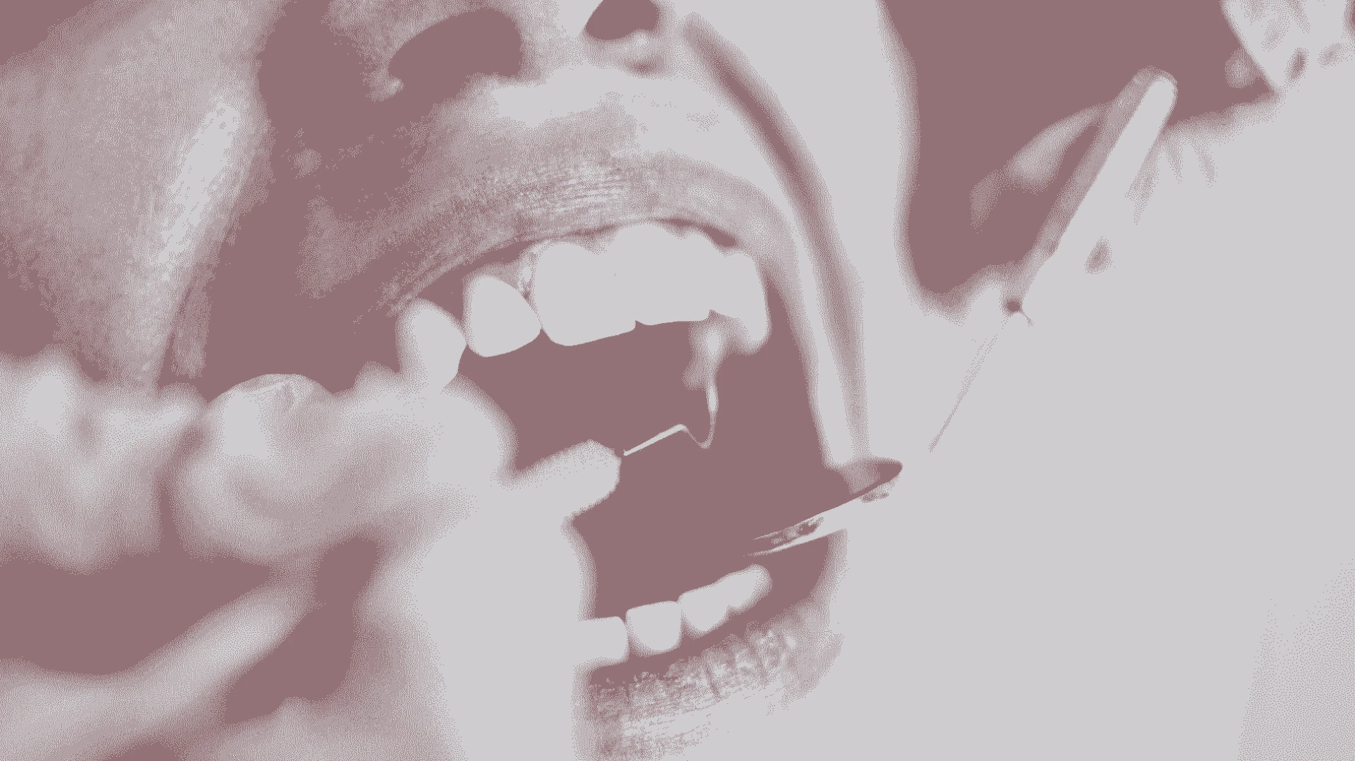 Factors That Affect Dental Implant Cost