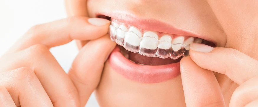Is Invisalign Rolla Mo Effective?
