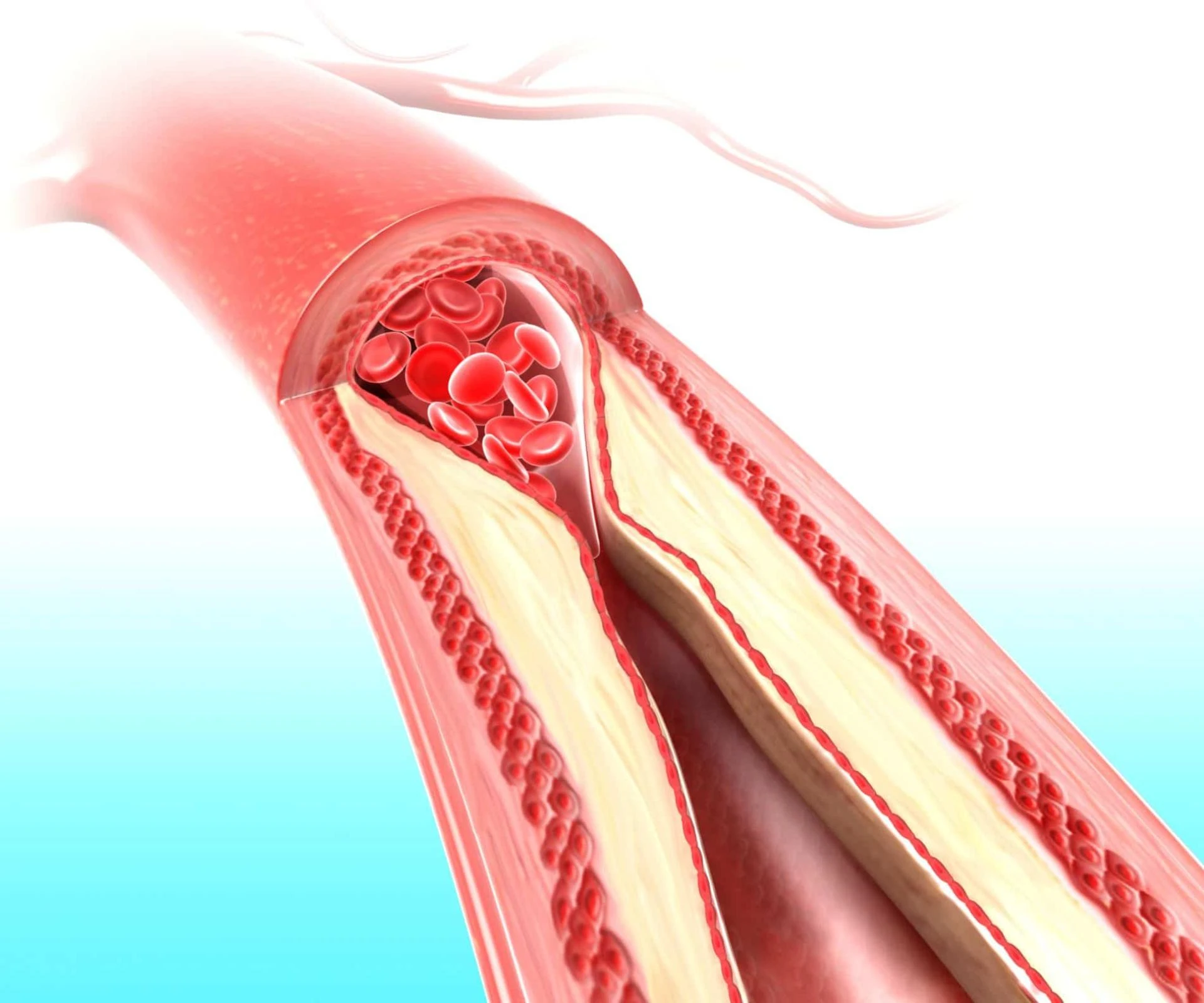 Now Is The Time For You To Know The Truth About Hemodialysis Access Graft.