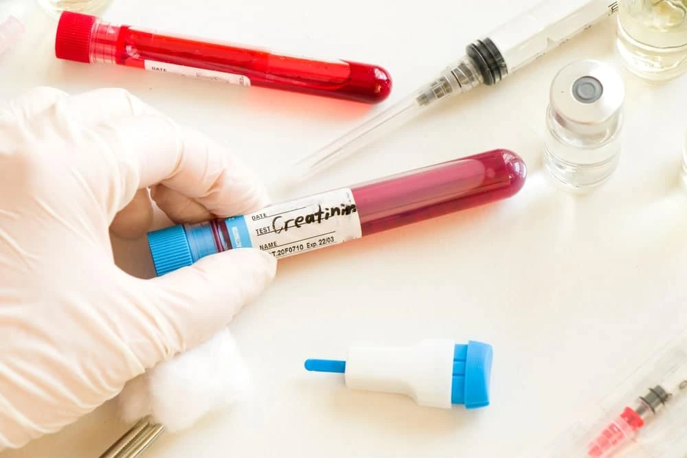 What Happens if the Creatinine Levels are Elevated?