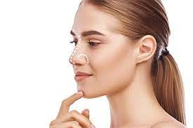 what is Rhinoplasty treatment
