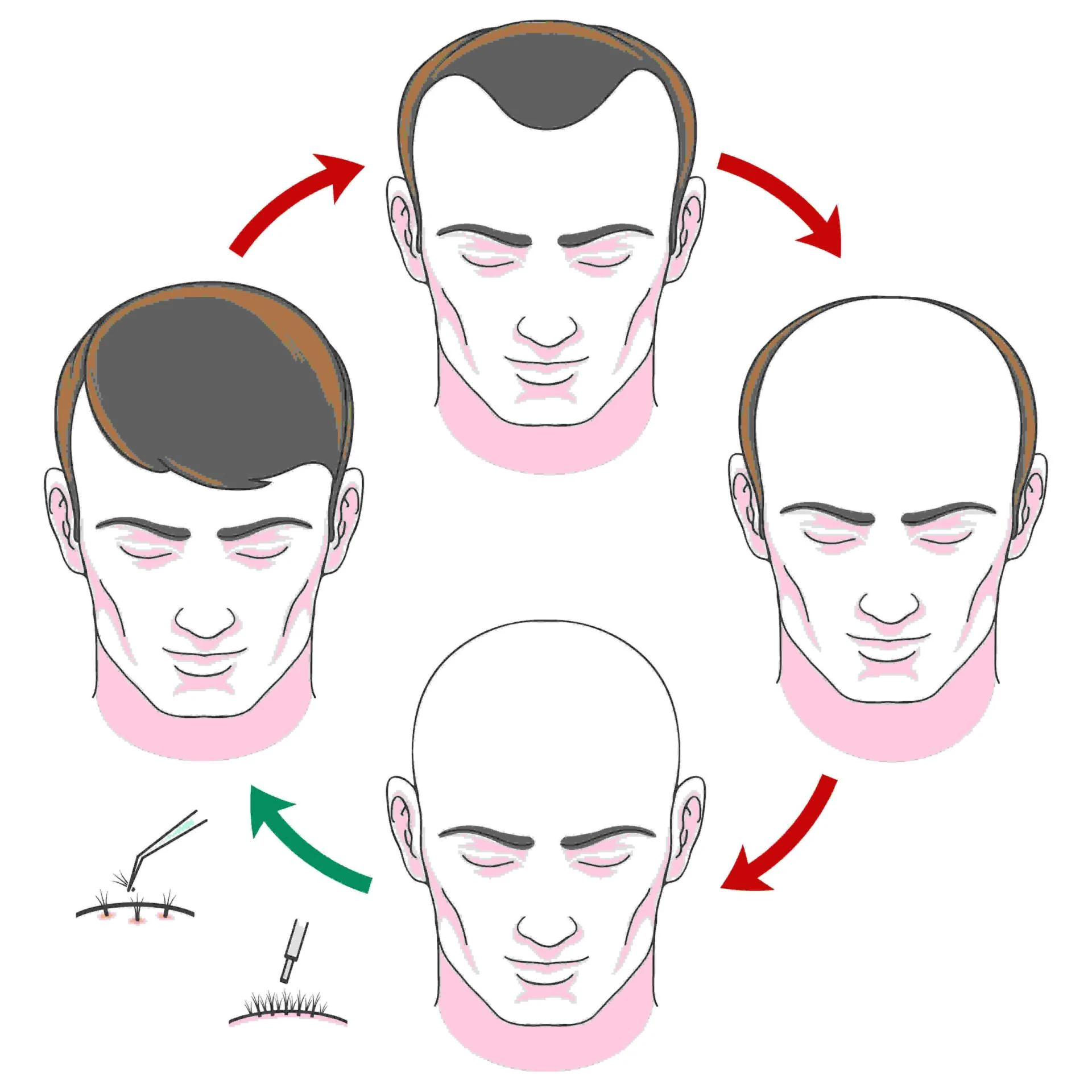 hair fall treatment in Kolhapur