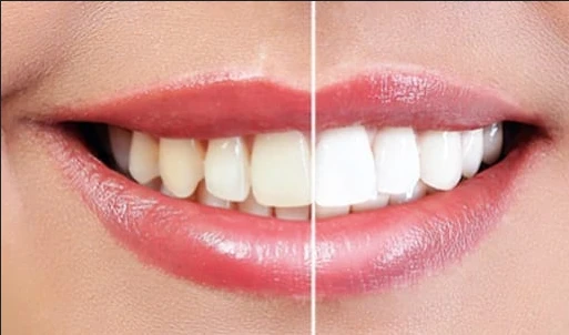 Dental Practices: Improving Local SEO Strategies