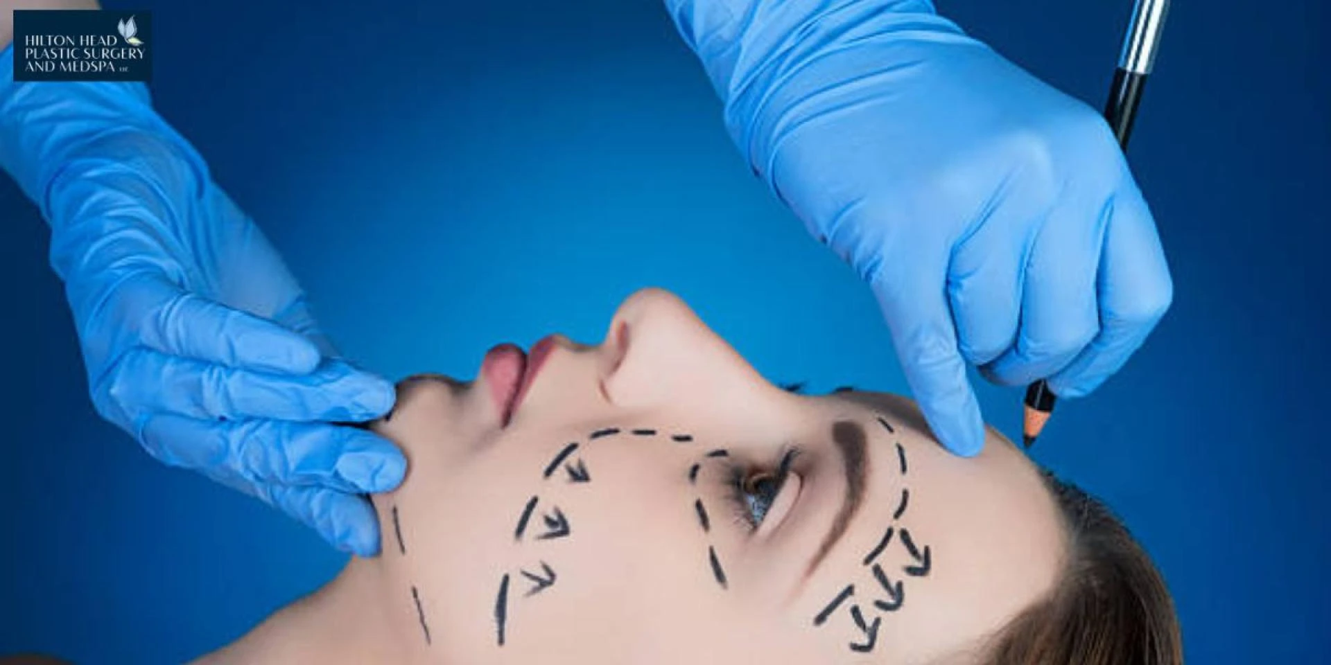 Face Lift Surgery: The Path to a Youthful Tomorrow