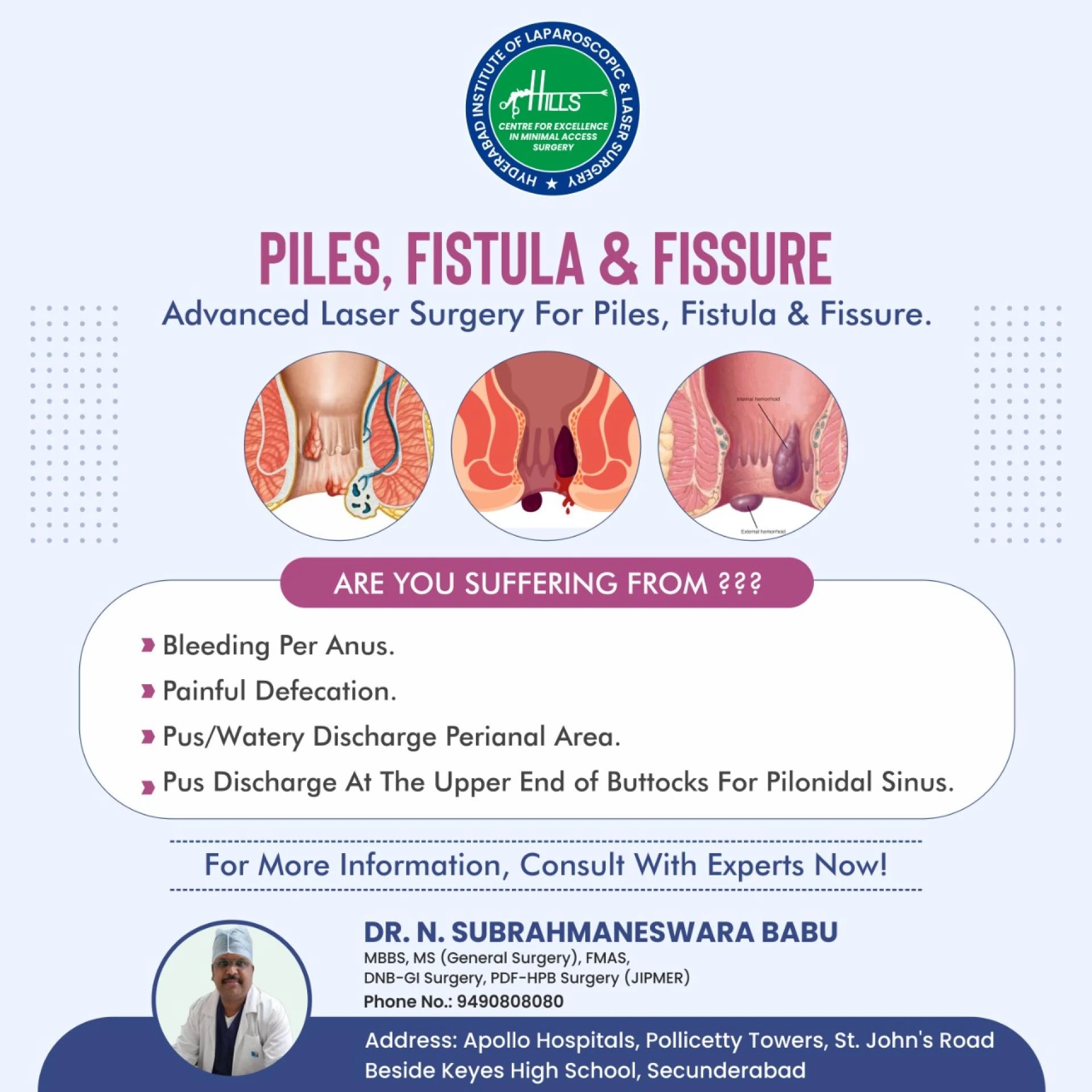 Advance Laser Surgery is a modern and effective treatment option for piles, fistulas, and fissures.