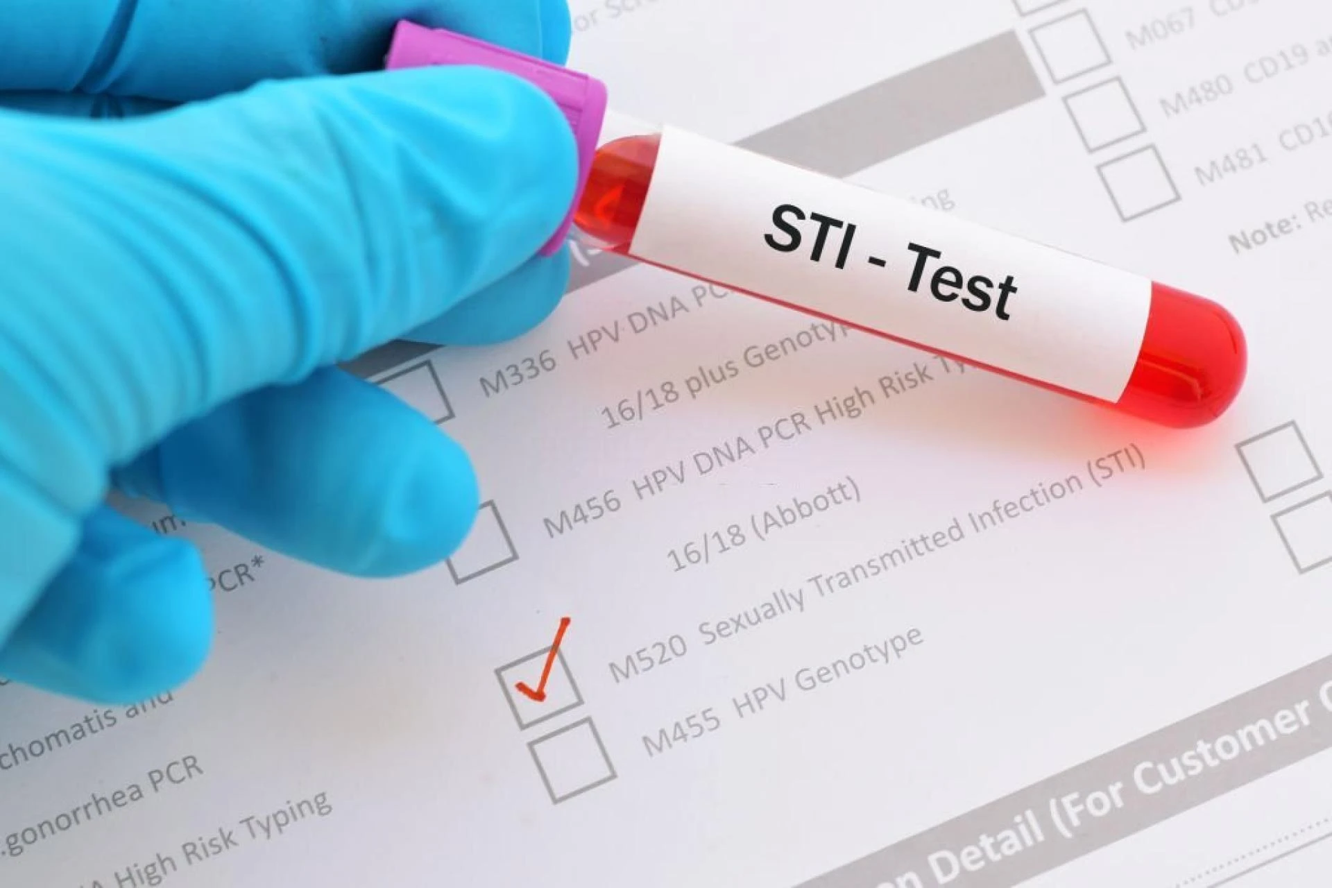 STD Testing And Treatment Services In California | Her Smart Choice