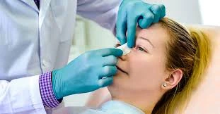 Absorbable Nasal Implant Devices Market Value Projected to Expand by 2027