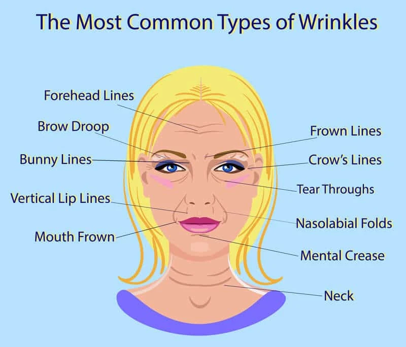 The Different Types of Wrinkles