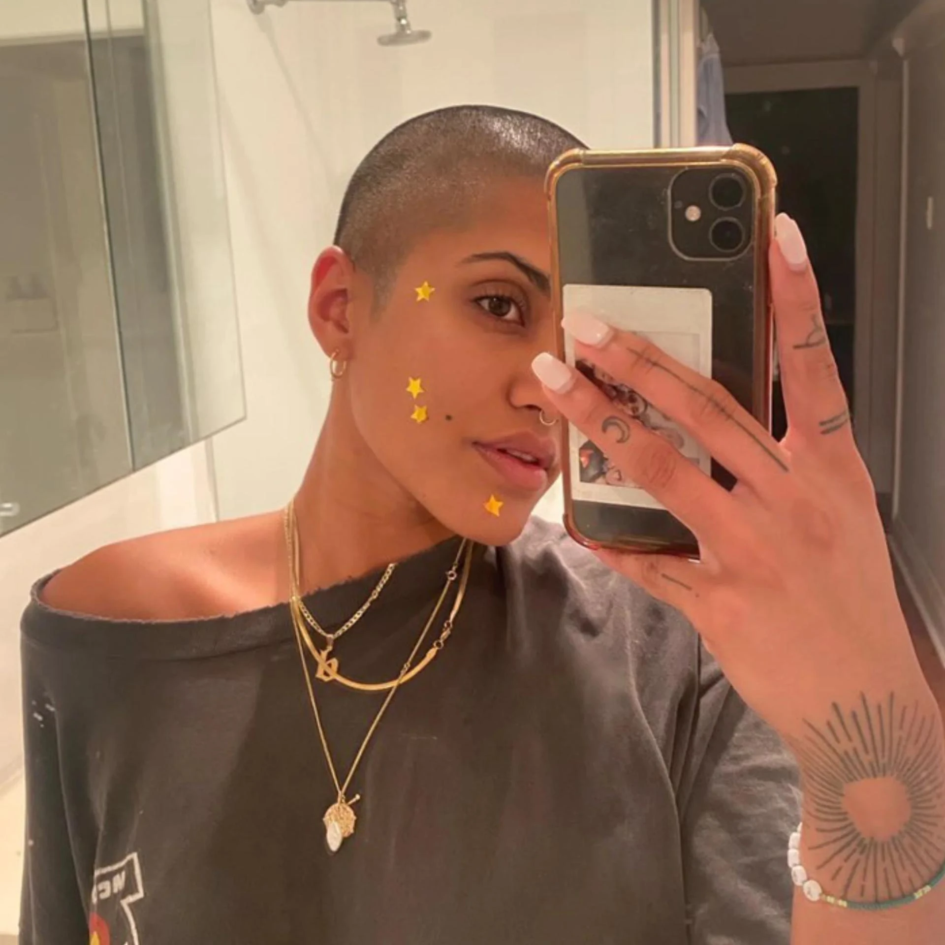 The Benefits of Pimple Patches: Why They're Worth a Try