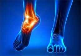 Reasons why knee pain treatment may be your only solution