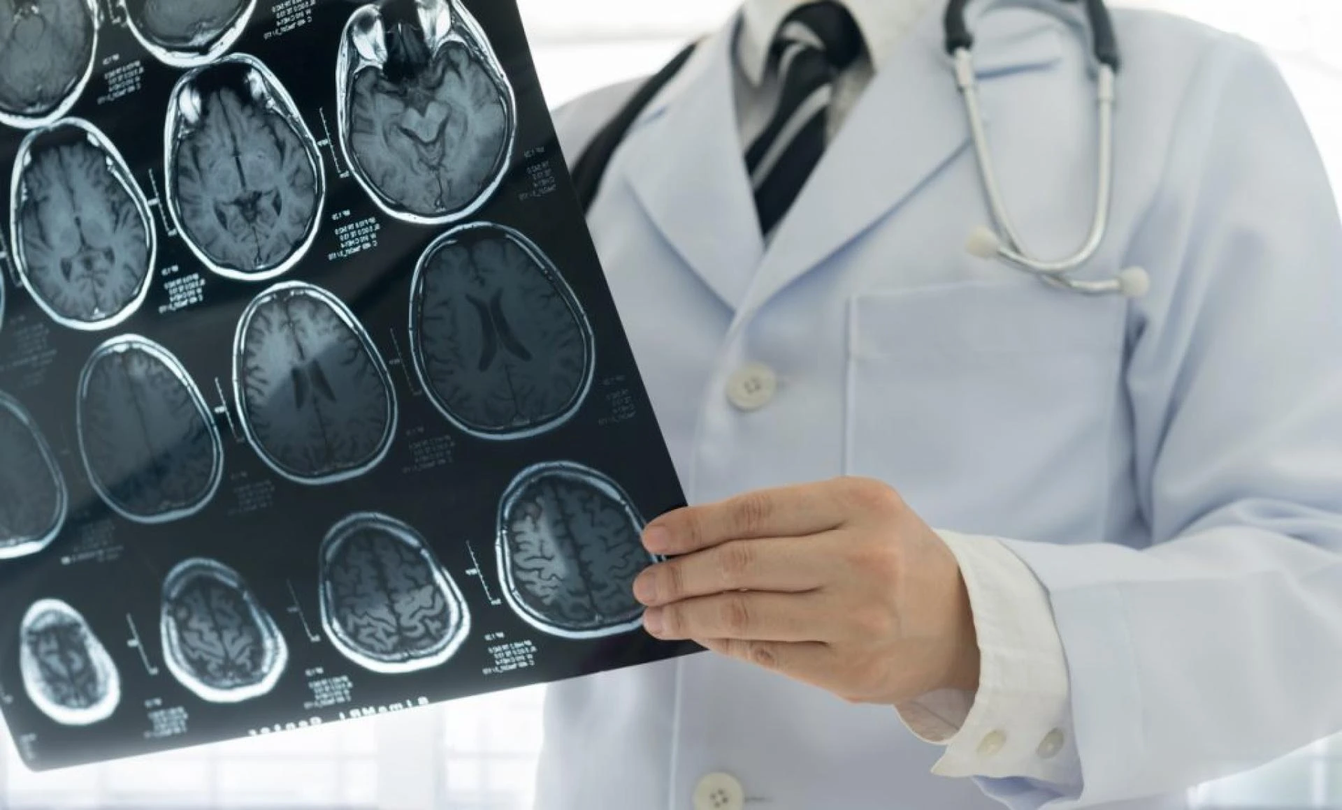 Explain What is a neurologist? What do they and when to see one?
