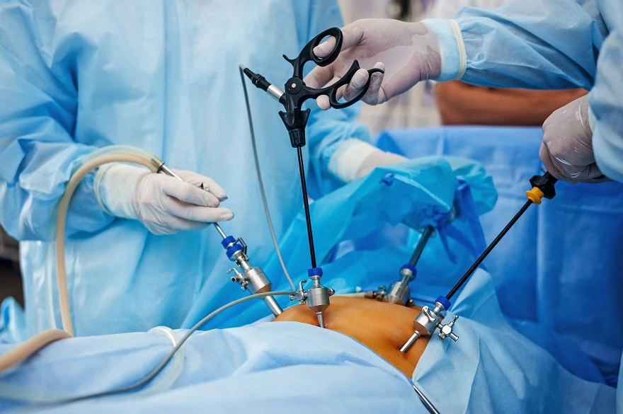 BEST WEIGHT LOSS SURGERY IN NSW