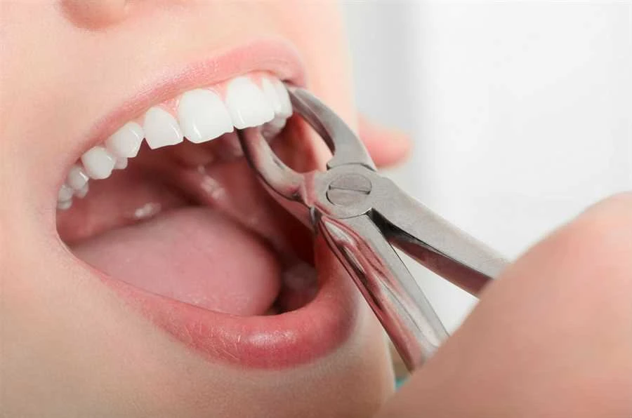 Can Anyone Avail of a Free Dental Treatment?
