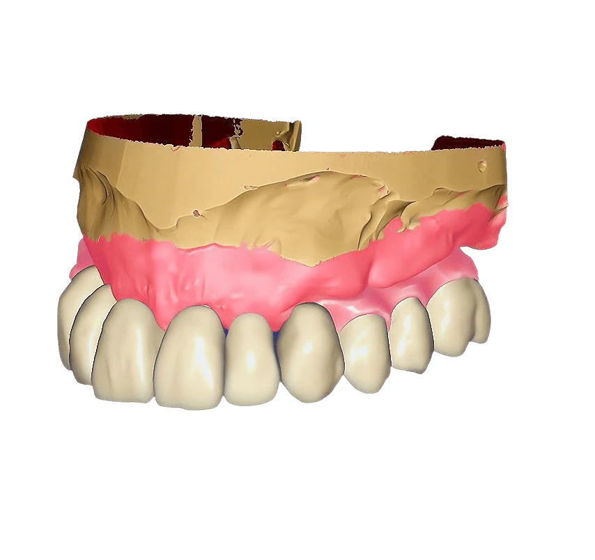 Exocad Designer Extraordinaire: Crafting Perfect Smiles