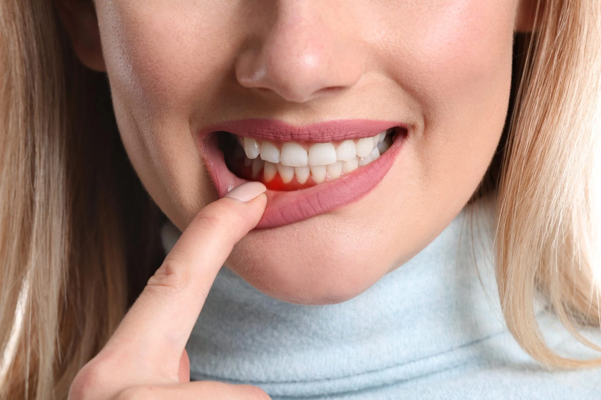 Preventing Gum Disease: Tips for Maintaining Healthy Gums