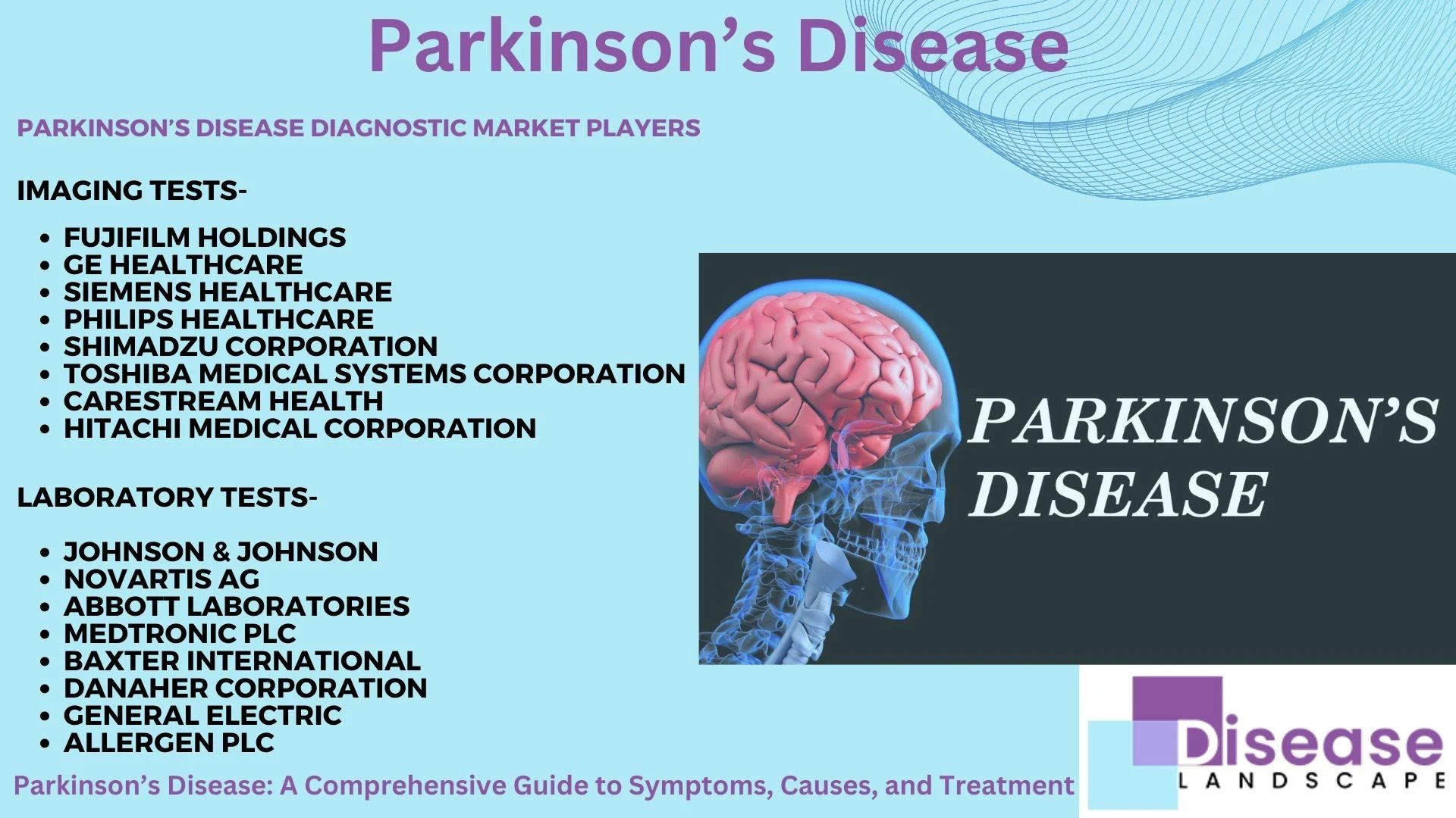 Parkinson's Disease: A Comprehensive Guide to Diagnosis and Treatment